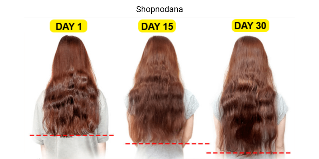 Vitamins for hair growth and stop hair fall immediately - Shopno Dana