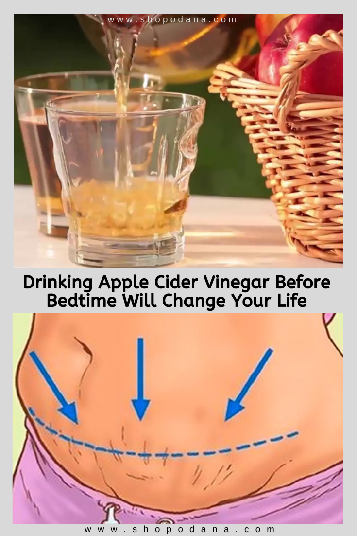 Apple cider vinegar for weight loss-shopnodana