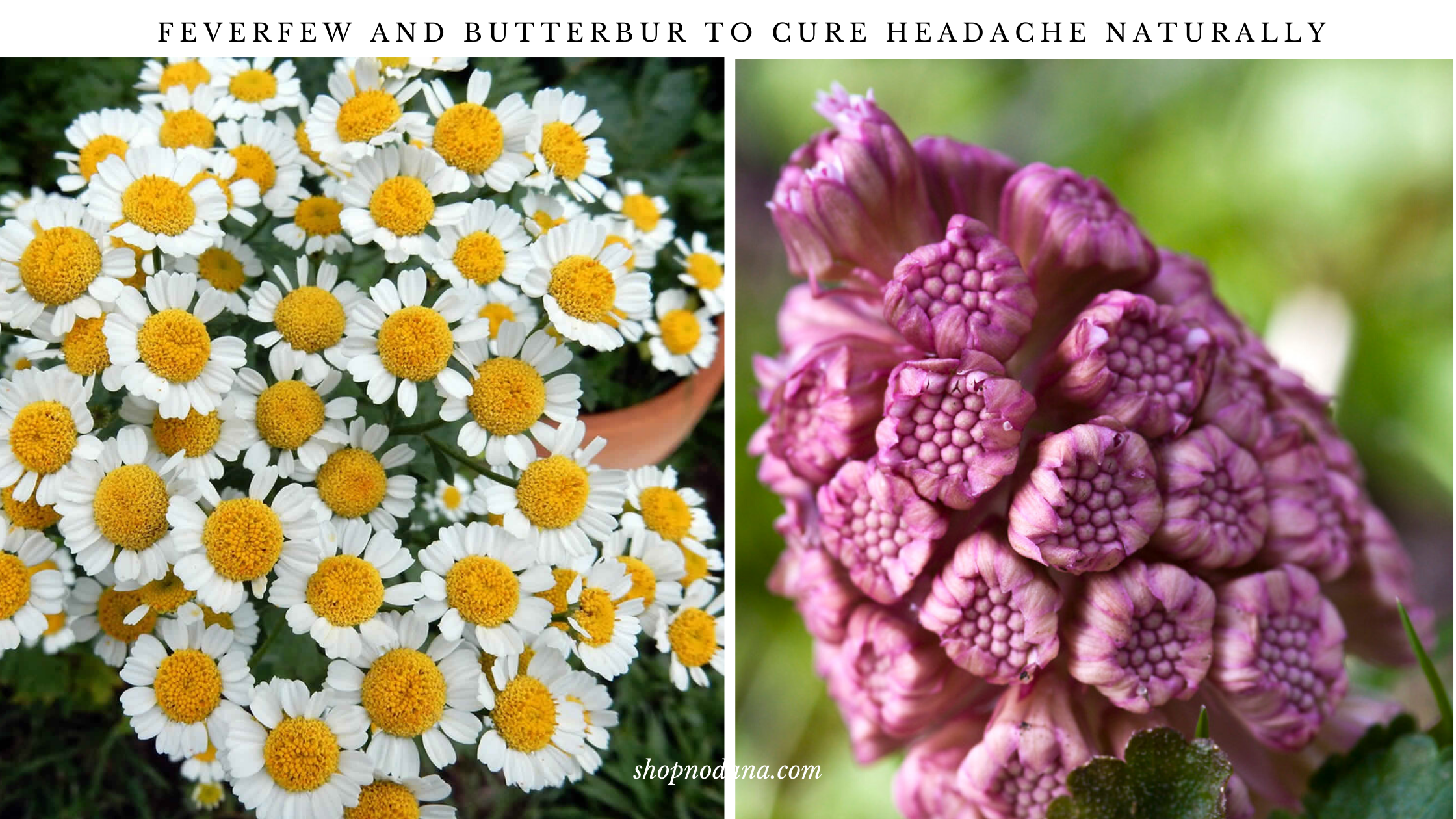 Feverfew and butterbur to cure headache naturally