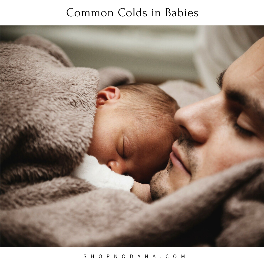 Common Colds in Babies