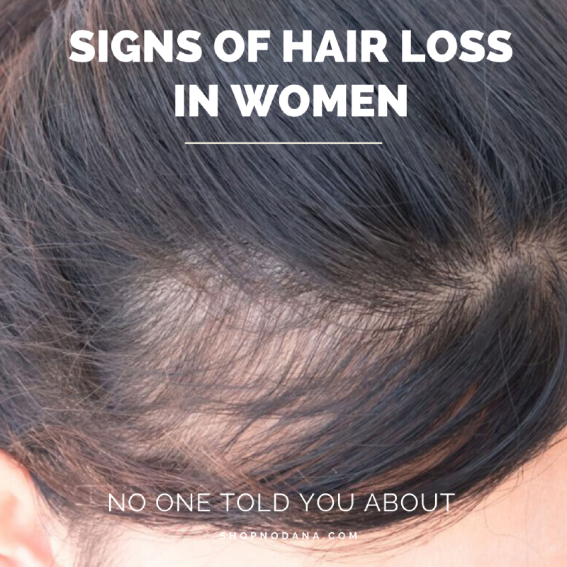 Causes-of-Hairloss-in-Women