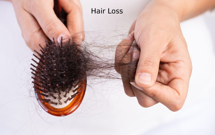 Causes-of-hair-loss-in-women