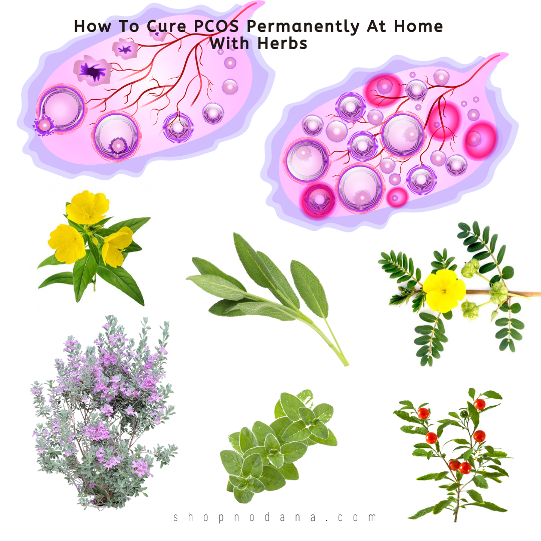 How To Cure PCOS Permanently At Home With Herbs
