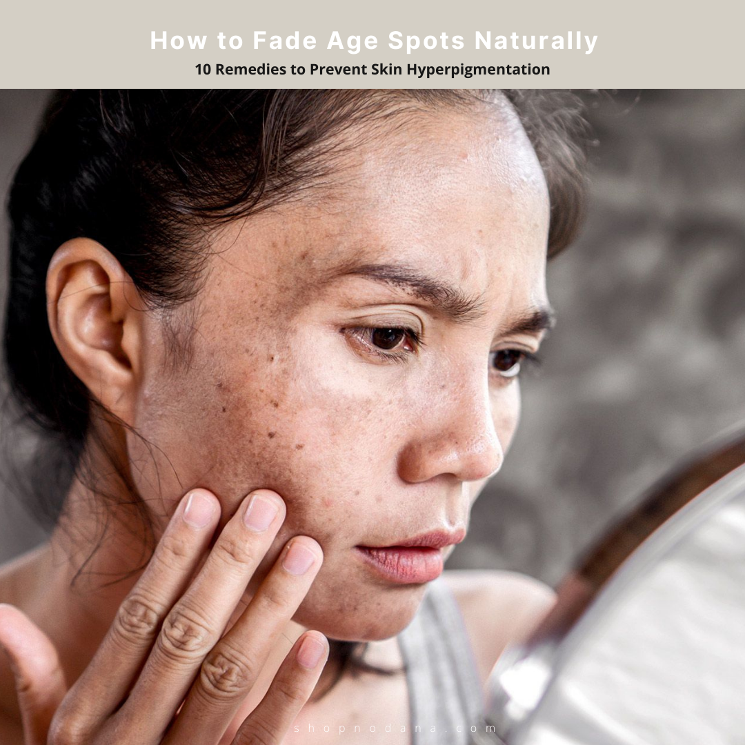 How to Fade Age Spots Naturally