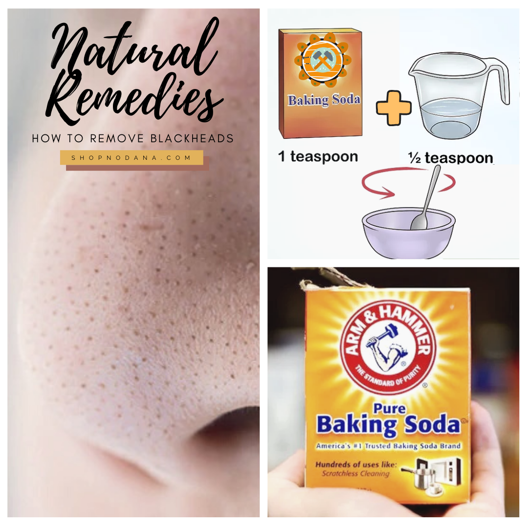 How to Remove Blackheads on Nose with baking soda