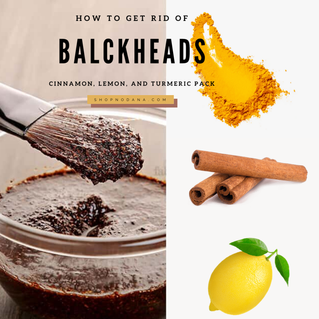 How to Remove Blackheads on Nose with cinnamon, lemon and turmeric