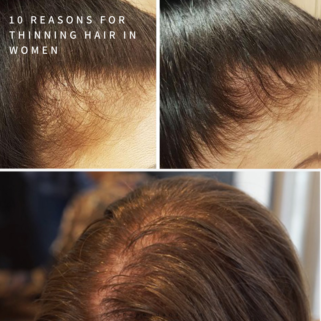 REASONS FOR THINNING HAIR IN WOMEN
